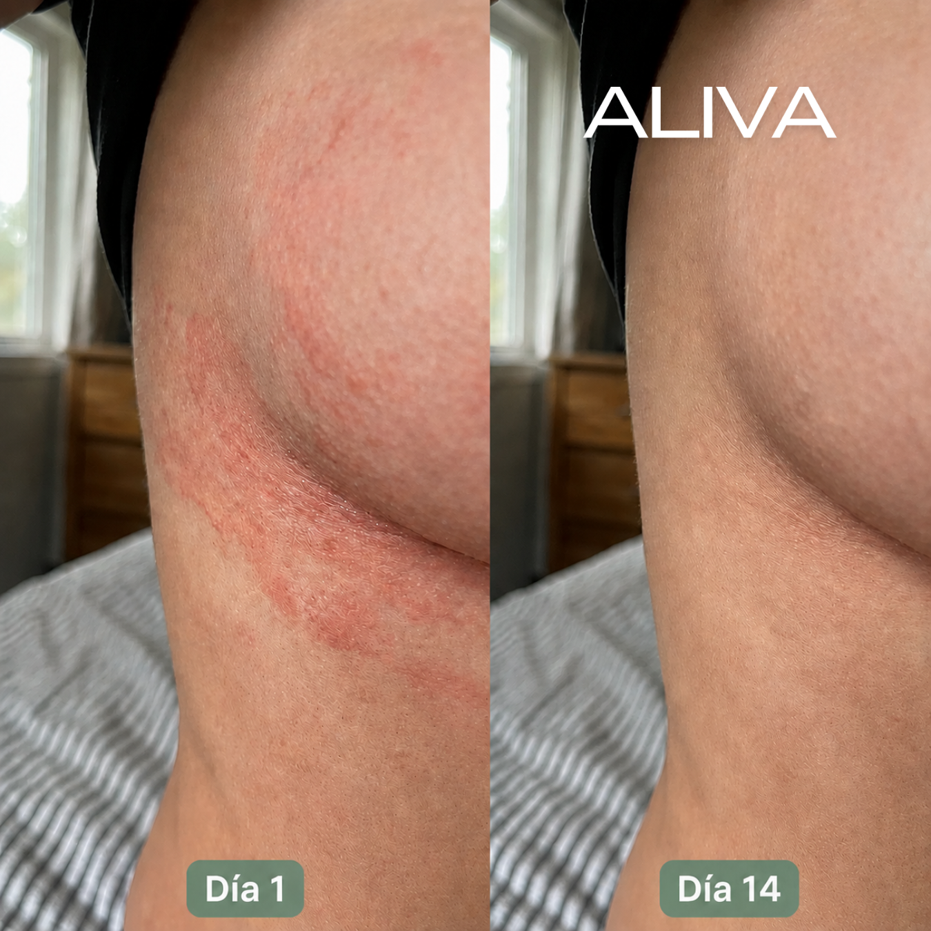 Aliva Fórmula Anti-Rozaduras y Sarpullidos