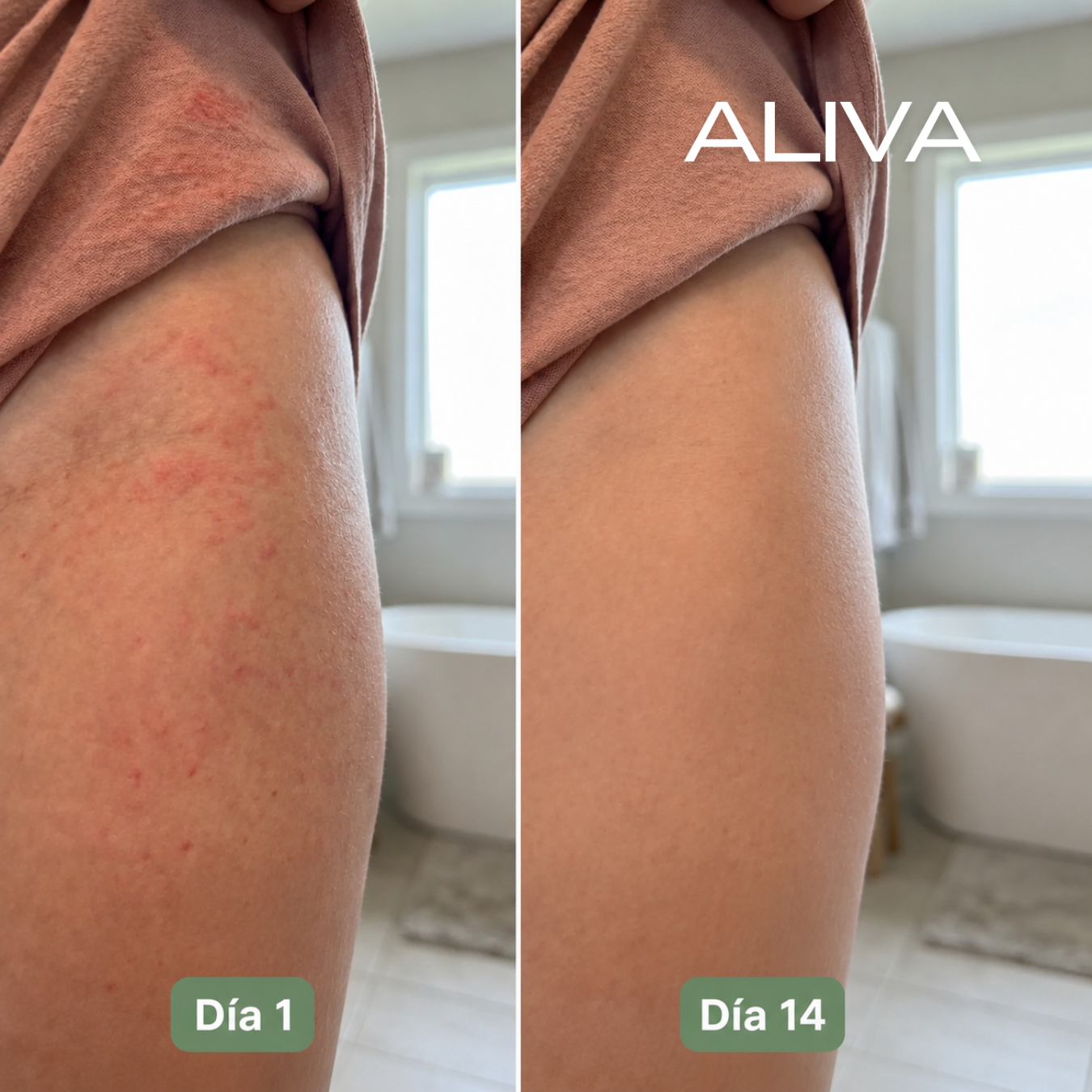 Aliva Fórmula Anti-Rozaduras y Sarpullidos