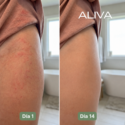 Aliva Fórmula Anti-Rozaduras y Sarpullidos